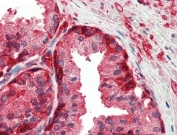 IHC testing of FFPE human prostate tissue with GSTP1 antibody at 5ug/ml. Steamed antigen retrieval with citrate buffer pH 6, AP-staining.