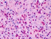 IHC staining of FFPE human pancreas tissue with Triosephosphate isomerase antibody at 5ug/ml. HIER: steamed with pH6 citrate buffer, AP-staining.