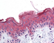 IHC testing of FFPE human skin with ADAM17 antibody at 3.75ug/ml. HIER: steamed antigen retrieval with pH6 citrate buffer; AP-staining.