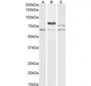 Western blot testing of human A) K562, B) A549 and C) Caco-2 cell lysate with TG2 antibody. Predicted molecular weight: ~78 kDa.