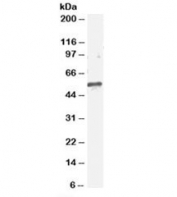 Western blot testing of mouse brain with ARFGAP3 antibody at 2ug/ml. Predicted molecular weight: ~57/52kDa (isoforms 1/2).