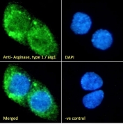 IF/ICC staining of fixed and permeabilized human HepG2 cells with Arginase antibody (green) at 10ug/ml and DAPI nuclear stain (blue).