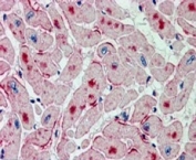 IHC staining of FFPE human heart with ATGL antibody at 2.5ug/ml. HIER: steamed with pH6 citrate buffer, AP-staining. Staining of distinct spots in the myocardial fibers (transverse section) is seen.