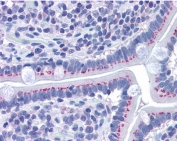 IHC staining of FFPE human small intestine with GOLPH2 antibody at 3.75ug/ml. HIER: steamed with pH6 citrate buffer, AP-staining.