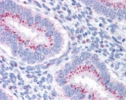 IHC staining of FFPE human uterus with GOLPH2 antibody at 3.75ug/ml. HIER: steamed with pH6 citrate buffer, AP-staining.