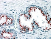 IHC staining of FFPE human prostate with GOLPH2 antibody at 3.75ug/ml. HIER: steamed with pH6 citrate buffer, AP-staining.