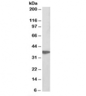 Western blot testing of Jurkat lysate with AIMP1 antibody at 0.3ug/ml. Predicted molecular weight: ~34/37kDa (isoforms 1/2).
