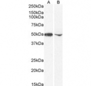 Western blot testing of human A) K562 and B) ThP-1 cell lysate with DC-SIGN antibody. Predicted molecular weight ~46 kDa.