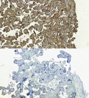 IHC staining of FFPE human placental tissue with DC-SIGN antibody (top) and without DC-SIGN antibody (bottom, negative control) at 6ug/ml. Required HIER: steamed antigen retrieval with pH6 citrate buffer; HRP-staining.