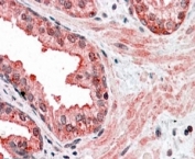 IHC testing of FFPE human prostate with CCNDBP1 at 4ug/ml. HIER: steamed with pH6 citrate buffer, AP-staining.