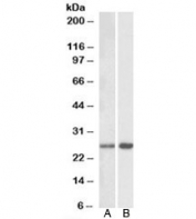 Western blot testing with MOBKL3 antibody: Lane A: mouse brain at 0.3ug/ml; Lane B: rat brain at 1ug/ml. Predicted/observed molecular weight: ~26 kDa.