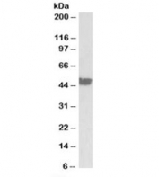 Western blot testing of human colon lysate with CK20 antibody at 0.03ug/ml. Predicted molecular weight: ~49kDa.
