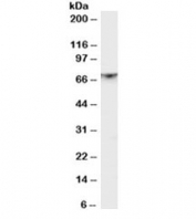 Western blot testing of rat brain lysate with PAK1 antibody at 1ug/ml. Expected molecular weight 60~70 kDa.