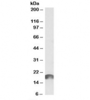 Western blot testing of cerebral cortex lysate with ANAPC11 antibody at 1ug/ml. Predicted molecular weight: ~20kDa (NCBI # NP_001002244.1 or UniProt # Q9NYG5-2).