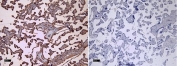 IHC testing of FFPE human placental tissue with CD32 antibody (left) at 8ugl/ml and without primary Ab (right). Required HIER: steamed antigen retrieval with pH6 citrate buffer; HRP-staining.