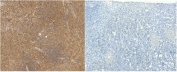 IHC staining of FFPE human spleen tissue with (left) and without (right) CD68 antibody. Required HIER: steamed antigen retrieval with pH6 citrate buffer.