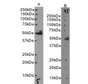 Western blot testing of human A) kidney and B) placenta tissue lysate with AIBZIP antibody at 0.5ug/ml. Predicted molecular weight: ~45 kDa.