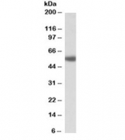Western blot testing of human prostate lysate with ADRA1A antibody at 1ug/ml. Predicted molecular weight: ~52kDa.