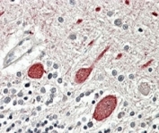 IHC testing of FFPE human cerebellum with Melatonin receptor 1B antibody at 4ug/ml. HIER: steamed with pH6 citrate buffer, AP-staining.