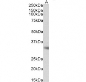 Western blot of mouse adipose lysate with Monoglyceride lipase antibody at 0.5ug/ml. Predicted molecular weight: ~33 kDa.