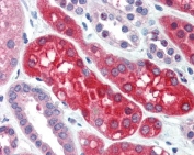 IHC staining of FFPE human kidney with Ezrin antibody at 4ug/ml. HIER: steamed with pH6 citrate buffer, AP-staining.