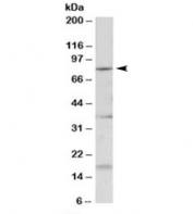 Western blot testing of mouse fetal brain lysate with Kcnc3 antibody at 0.2ug/ml. Predicted molecular weight: ~80kDa.