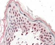 IHC testing of FFPE human skin with SRCAP antibody at 5ug/ml. HIER: steamed with pH6 citrate buffer, AP-staining.