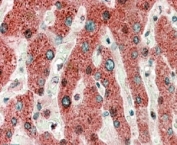 IHC testing of FFPE human liver with HRASLS2 antibody at 5ug/ml. HIER: microwaved with pH9 Tris/EDTA buffer, HRP-staining.