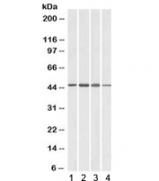 Western blot testing of brain lysate from 1) human, 2) mouse, 3) rat and 4) pig with ADAP1 antibody at 1ug/ml. Predicted molecular weight: ~43kDa.
