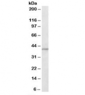 Western blot testing of human brain lysate with ADAP1 antibody at 1ug/ml. Predicted molecular weight: ~43kDa.