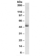 Western blot testing of human albumin-depleted plasma lysate with APOH antibody at 1ug/ml. Predicted molecular weight: ~38/50 kDa (unmodified/glycosylated).
