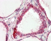 IHC staining of FFPE human thyroid gland with COX4I1 antibody at 2.5ug/ml. HIER: steamed with pH6 citrate buffer, AP-staining.