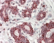 IHC staining of FFPE human breast with Aconitase 3 antibody at 3.8ug/ml. HIER: steamed with pH6 citrate buffer, AP-staining.