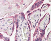 IHC testing of FFPE human placenta tissue with FAM62A antibody at 3.75ug/ml. Required HIER: steamed antigen retrieval with pH6 citrate buffer; AP-staining.