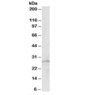 Western blot testing of mouse lung lysate with RHOGDI antibody at 1ug/ml. Predicted molecular weight: ~23 kDa, routinely observed at ~29 kDa.
