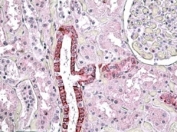 IHC staining of FFPE human kidney with TGFBI antibody at 3.8ug/ml. HIER: steamed with pH6 citrate buffer, AP-staining.