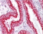 IHC testing of FFPE human uterus tissue with CHRNB2 antibody at 2.5ug/ml. Required HIER: steamed antigen retrieval with pH6 citrate buffer; AP-staining.