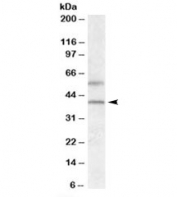 Western blot testing of human liver lysate with GPR81 antibody at 0.5g/ml. The expected ~40 kDa band and the additional ~55 kDa band are both blocked by addition of the immunizing peptide.