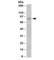 Western blot testing of human heart lysate with SETDB2 antibody at 0.1ug/ml. Predicted molecular weight: ~82kDa.