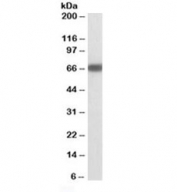 Western blot testing of mouse brain lysate with GAD67 antibody at 1ug/ml. Predicted molecular weight ~67kDa.