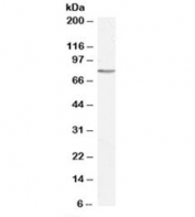 Western blot testing of K562 cell lysate with GAB2 antibody at 0.5ug/ml. Predicted molecular weight: ~75kDa.
