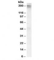 Western blot testing of human heart lysate with CACNA1C antibody at 0.5ug/ml. Predicted molecular weight: ~249kDa, observed here at ~200kDa.