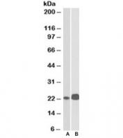 Western blot testing of Jurkat [A] and Molt4 [B] lysates with CD3e antibody at 0.1ug/ml. Expected/observed molecular weight ~23kDa.