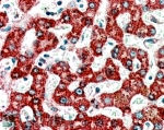 IHC staining of FFPE human liver with ACADM antibody at 4ug/ml. HIER: steamed with pH6 citrate buffer, AP-staining.