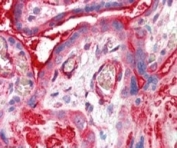 IHC testing of FFPE human placenta with ADAP2 antibody at 5ug/ml. HIER: steamed with pH6 citrate buffer, AP-staining.