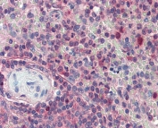 IHC testing of FFPE human spleen tissue with Importin beta antibody at 5ug/ml. Required HIER: steam section in pH6 citrate buffer for 20 min and allow to cool prior to tetsting.
