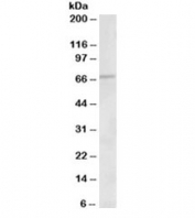 Western blot testing of human heart lysate with ACADVL antibody at 1ug/ml. Predicted molecular weight: ~68 kDa.