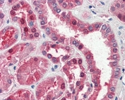 IHC staining of FFPE human kidney with GOT1 antibody at 5ug/ml. HIER: steamed with pH6 citrate buffer, AP-staining. 