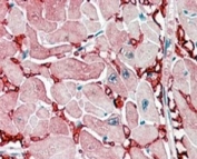 IHC staining of FFPE human heart with GOT1 antibody at 2.5ug/ml. HIER: steamed with pH6 citrate buffer, AP-staining. Strong staining of the capillary network between the myocardial fibers is seen (transverse secion).