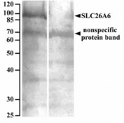 Western blot of human renal cortical brush-border membrane lysate (90ug protein denatured at 37oC for 30min) with (B) and without (A) blocking with the immunizing peptide. SLC26A6 antibody was used at 10ug/ml and detected by NBT/BCIP.